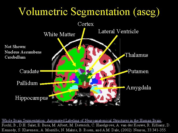 Volumetric Segmentation (aseg) Cortex White Matter Not Shown: Nucleus Accumbens Cerebellum Caudate Pallidum Lateral
