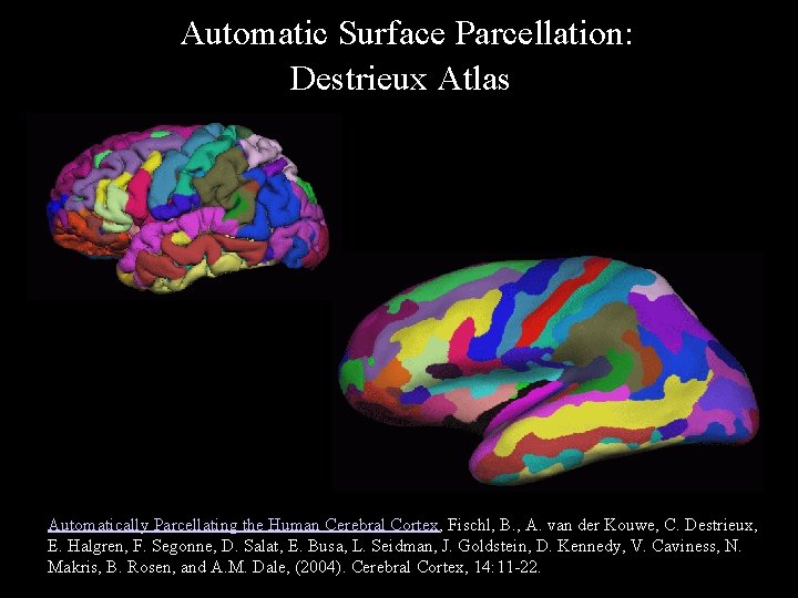 Automatic Surface Parcellation: Destrieux Atlas Automatically Parcellating the Human Cerebral Cortex, Fischl, B. ,