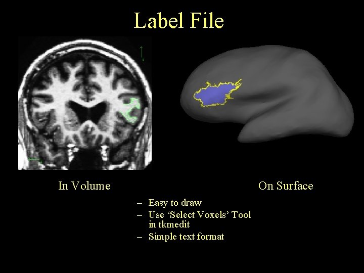 Label File In Volume On Surface – Easy to draw – Use ‘Select Voxels’