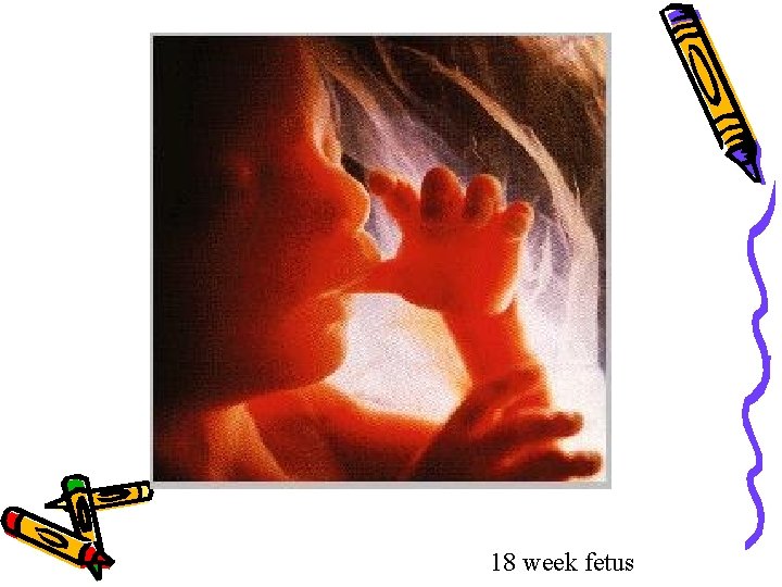 18 week fetus 