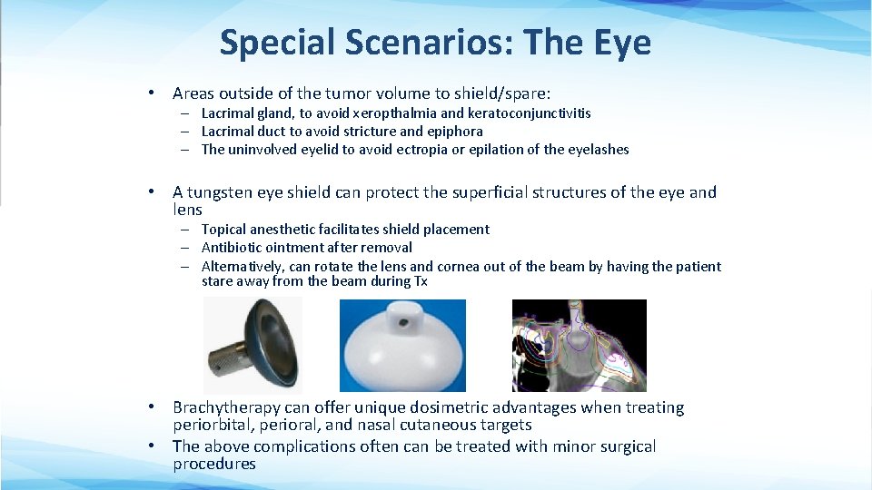 Special Scenarios: The Eye • Areas outside of the tumor volume to shield/spare: –