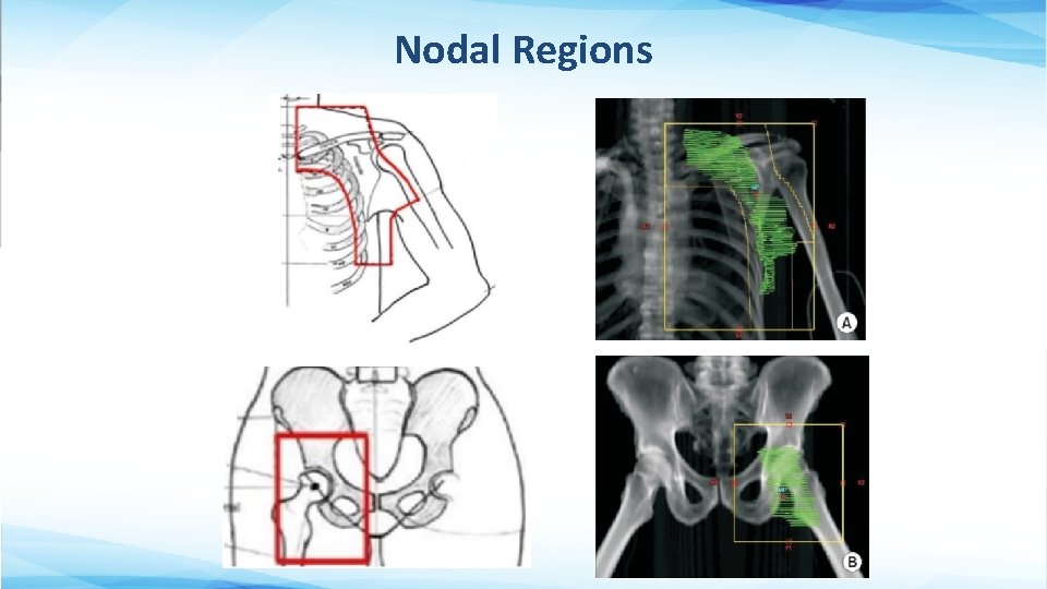 Nodal Regions 