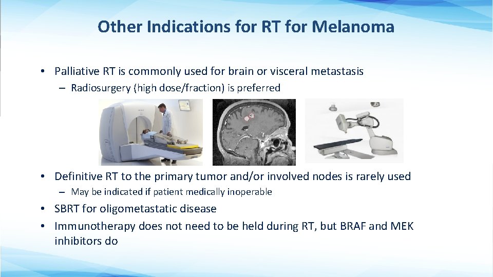 Other Indications for RT for Melanoma • Palliative RT is commonly used for brain