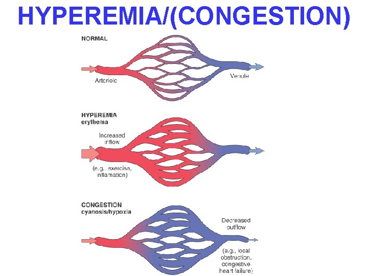 HYPEREMIA/(CONGESTION) 