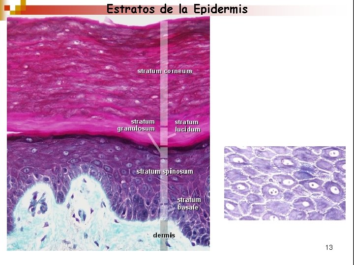 Estratos de la Epidermis 13 