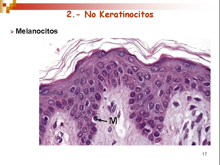 2. - No Keratinocitos Ø Melanocitos 17 