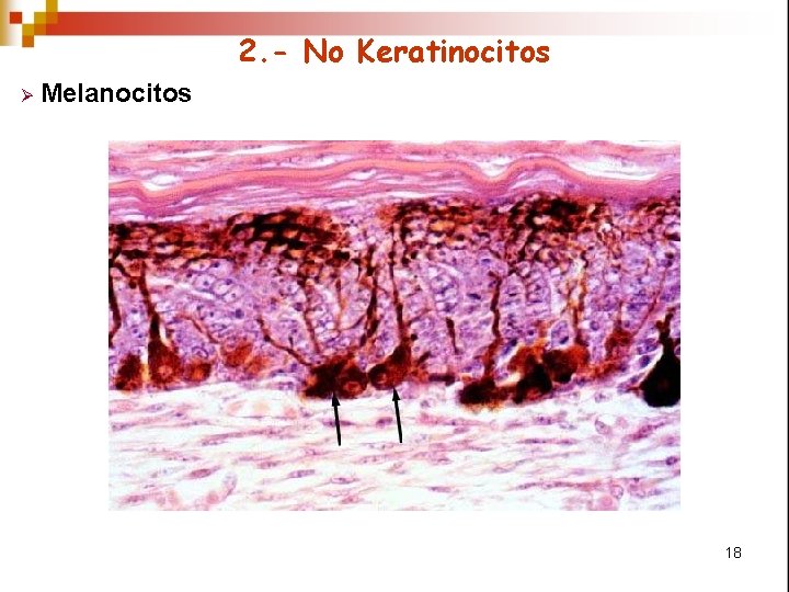 2. - No Keratinocitos Ø Melanocitos 18 