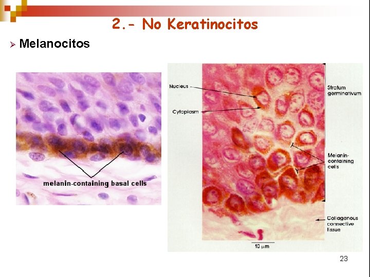 2. - No Keratinocitos Ø Melanocitos 23 