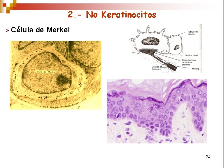 2. - No Keratinocitos Ø Célula de Merkel 24 