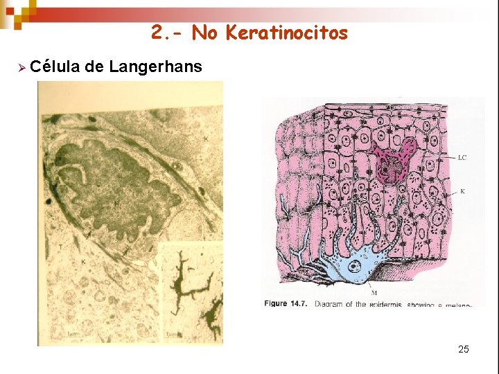 2. - No Keratinocitos Ø Célula de Langerhans 25 