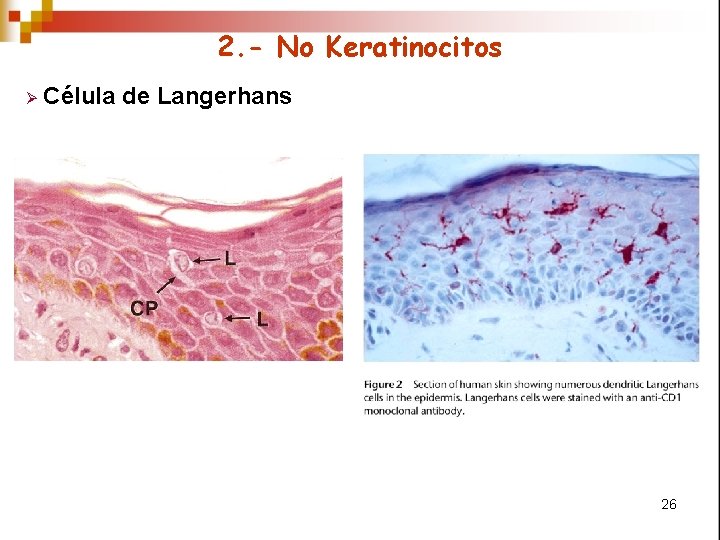2. - No Keratinocitos Ø Célula de Langerhans 26 