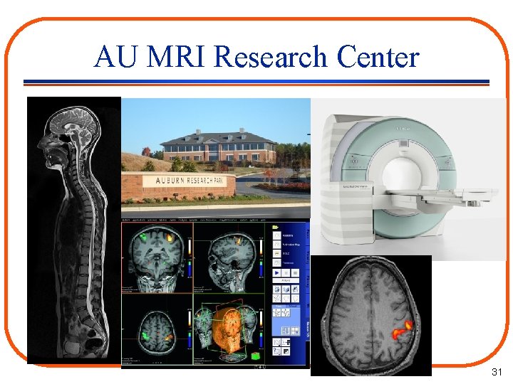 AU MRI Research Center 31 