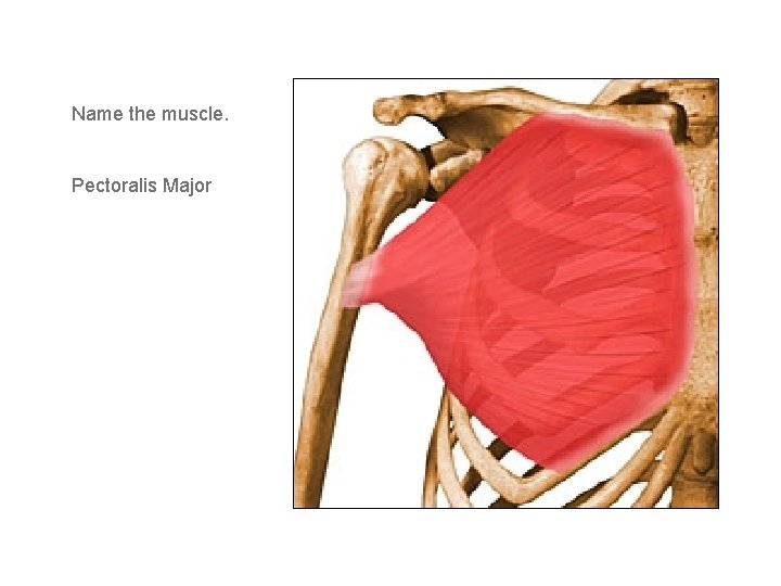 Name the muscle. Pectoralis Major 