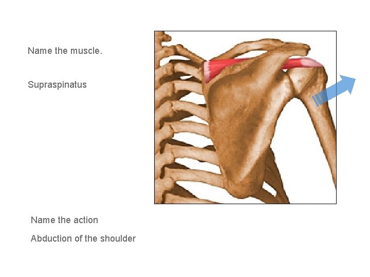 Name the muscle. Supraspinatus Name the action Abduction of the shoulder 