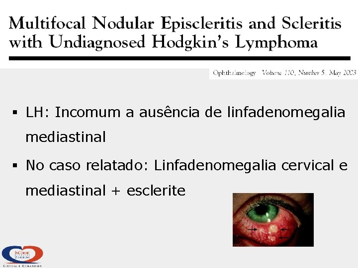 § LH: Incomum a ausência de linfadenomegalia mediastinal § No caso relatado: Linfadenomegalia cervical