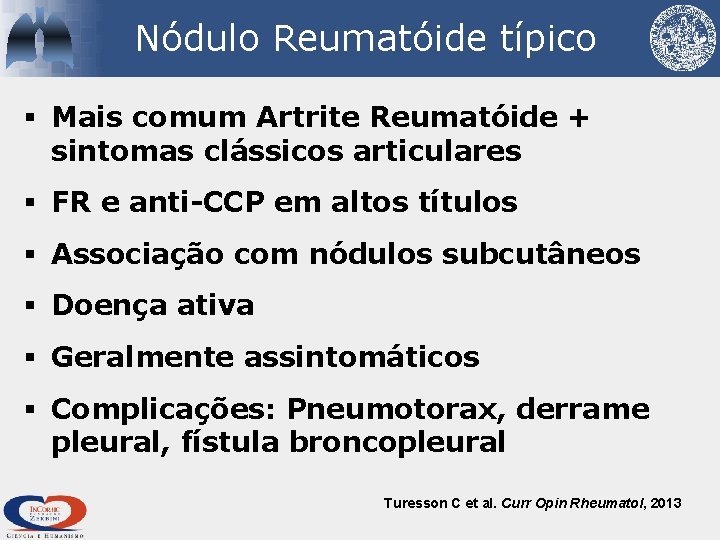 Nódulo Reumatóide típico § Mais comum Artrite Reumatóide + sintomas clássicos articulares § FR