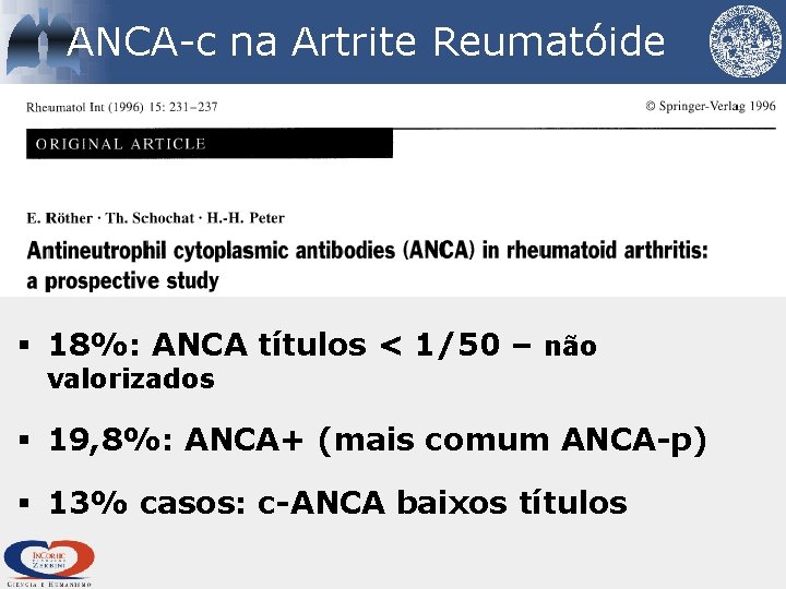 ANCA-c na Artrite Reumatóide § 18%: ANCA títulos < 1/50 – não valorizados §