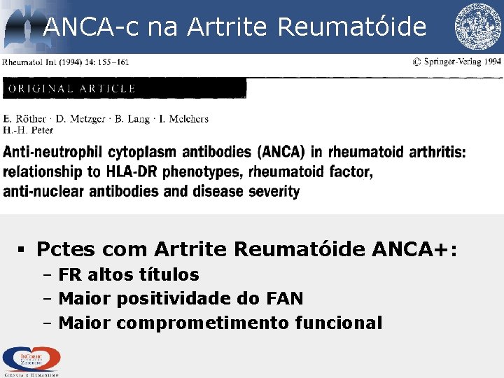 ANCA-c na Artrite Reumatóide § Pctes com Artrite Reumatóide ANCA+: – FR altos títulos