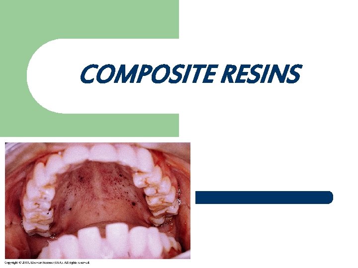 COMPOSITE RESINS 