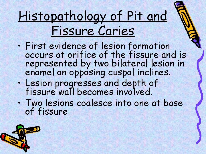 Histopathology of Pit and Fissure Caries • First evidence of lesion formation occurs at