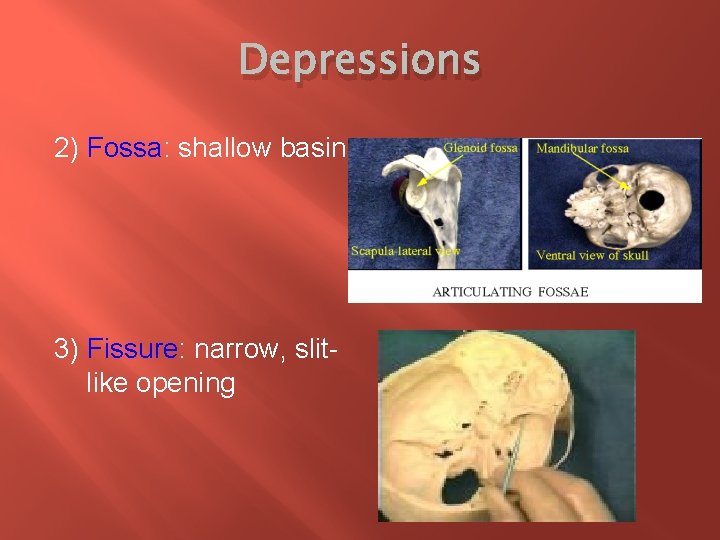 Depressions 2) Fossa: shallow basin 3) Fissure: narrow, slitlike opening 