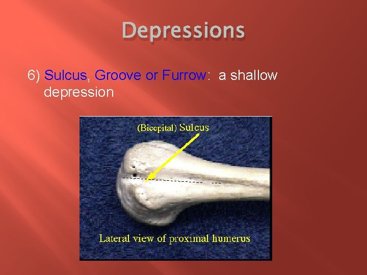 Depressions 6) Sulcus, Groove or Furrow: a shallow depression 