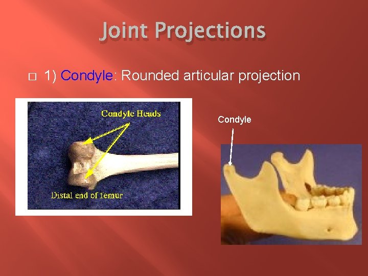 Joint Projections � 1) Condyle: Rounded articular projection Condyle 