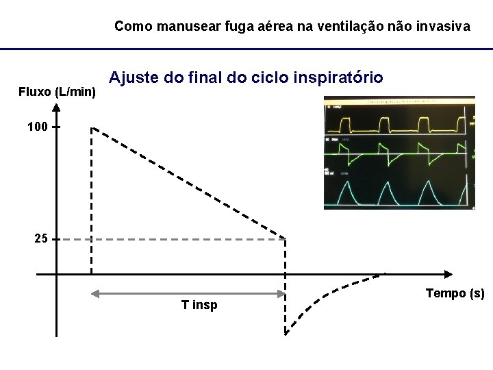 Como manusear fuga aérea na ventilação não invasiva Fluxo (L/min) Ajuste do final do