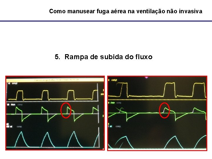 Como manusear fuga aérea na ventilação não invasiva 5. Rampa de subida do fluxo