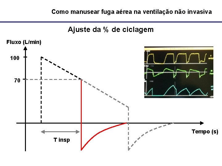 Como manusear fuga aérea na ventilação não invasiva Ajuste da % de ciclagem Fluxo