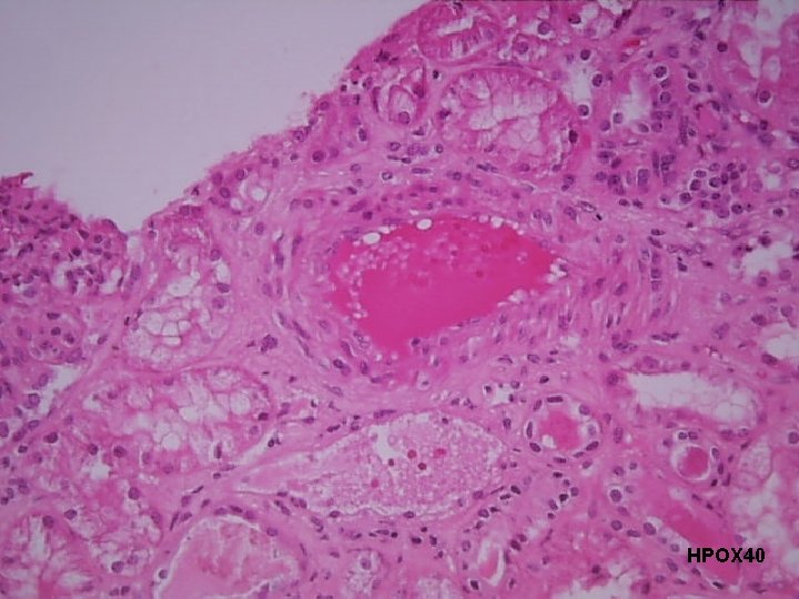 HPOX 40 HPOX 40