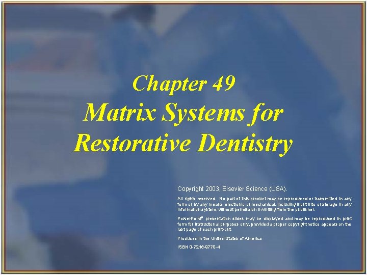 Chapter 49 Matrix Systems for Restorative Dentistry Copyright 2003, Elsevier Science (USA). All rights