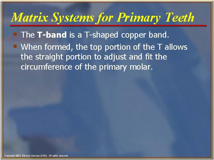 Matrix Systems for Primary Teeth § The T-band is a T-shaped copper band. §