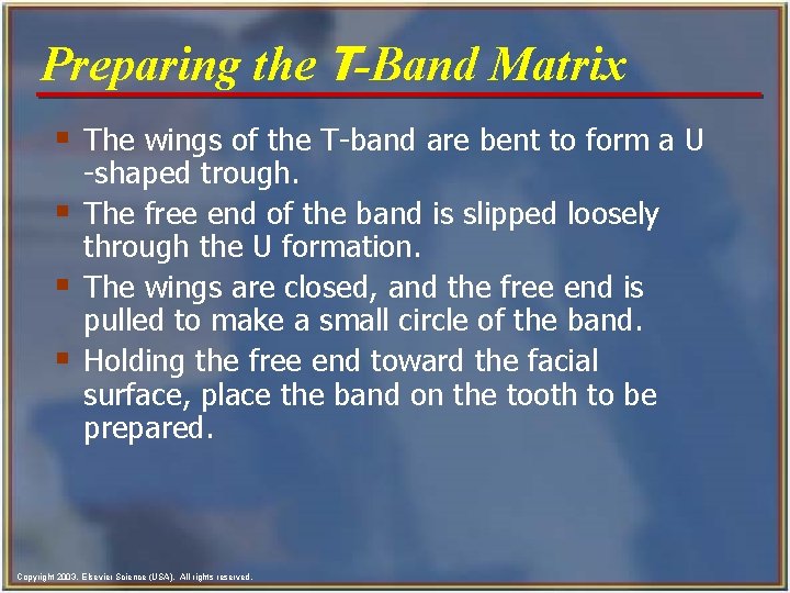 Preparing the T-Band Matrix § The wings of the T-band are bent to form