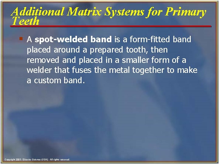 Additional Matrix Systems for Primary Teeth § A spot-welded band is a form-fitted band