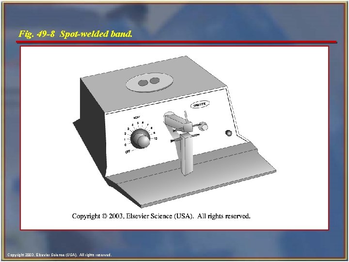 Fig. 49 -8 Spot-welded band. Copyright 2003, Elsevier Science (USA). All rights reserved. 