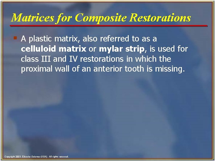 Matrices for Composite Restorations § A plastic matrix, also referred to as a celluloid