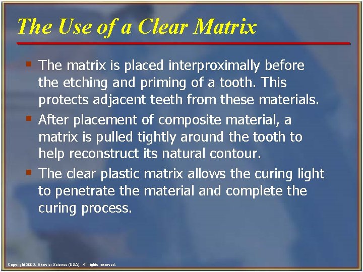 The Use of a Clear Matrix § The matrix is placed interproximally before §