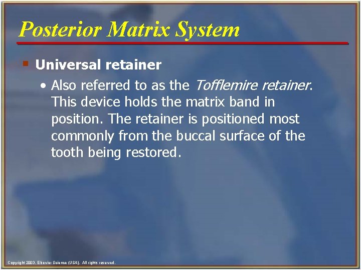 Posterior Matrix System § Universal retainer • Also referred to as the Tofflemire retainer.