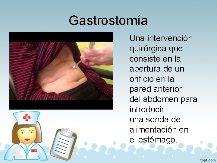 Gastrostomía Una intervención quirúrgica que consiste en la apertura de un orificio en la