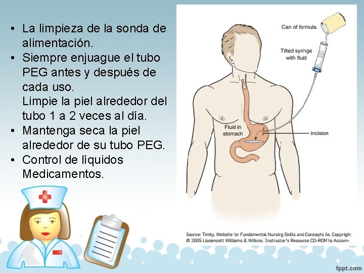  • La limpieza de la sonda de alimentación. • Siempre enjuague el tubo