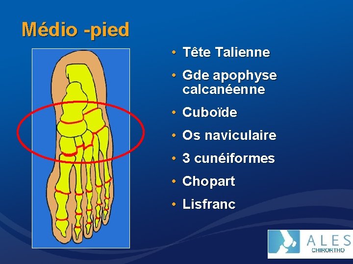 Médio -pied • Tête Talienne • Gde apophyse calcanéenne • Cuboïde • Os naviculaire