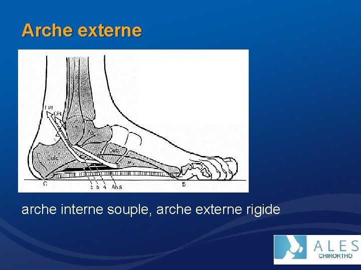 Arche externe arche interne souple, arche externe rigide 