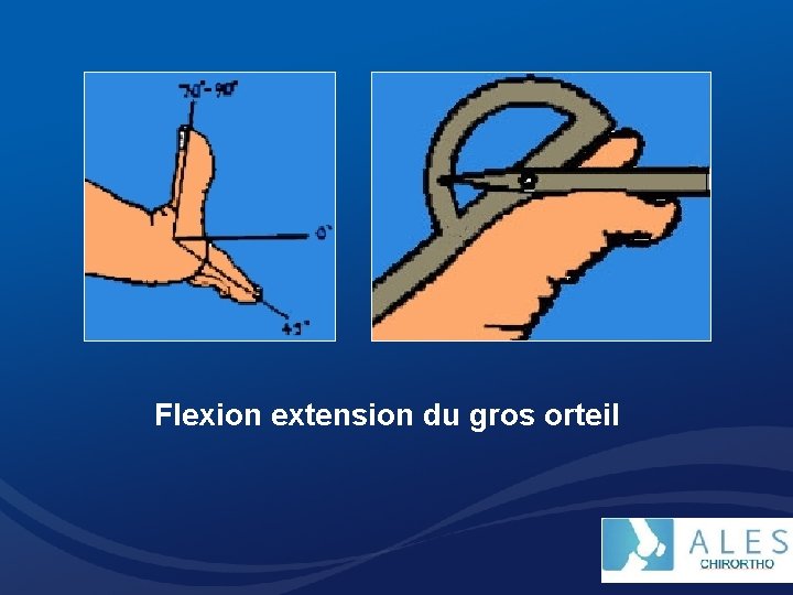 Flexion extension du gros orteil 