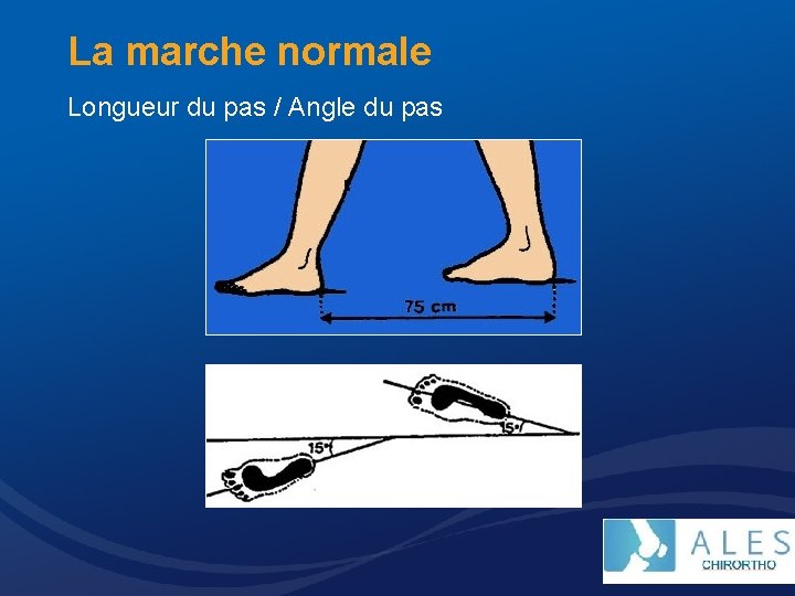 La marche normale Longueur du pas / Angle du pas 