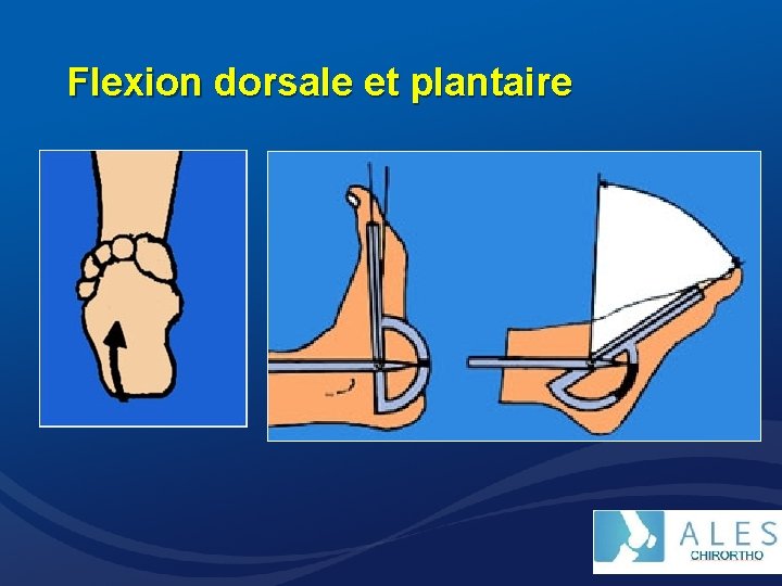 Flexion dorsale et plantaire 