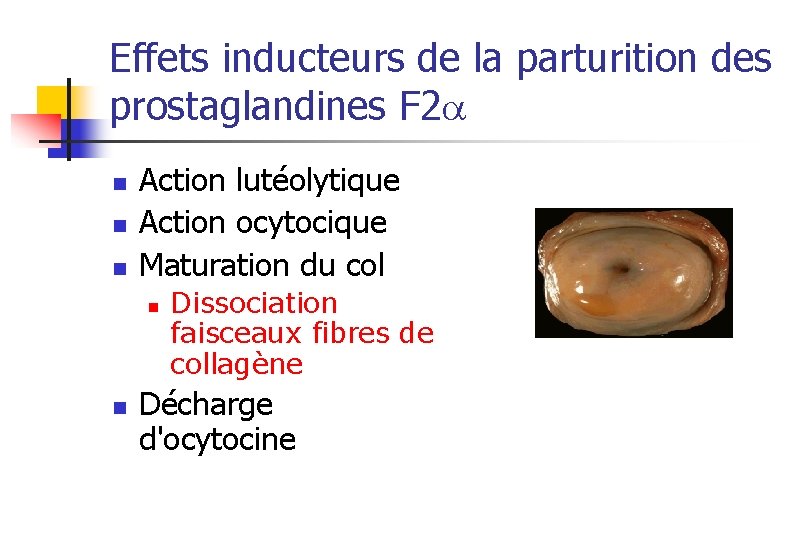 Effets inducteurs de la parturition des prostaglandines F 2 n n n Action lutéolytique