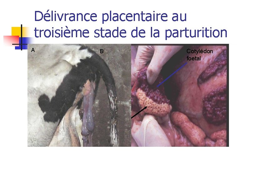 Délivrance placentaire au troisième stade de la parturition A B Caroncule maternelle Cotylédon foetal