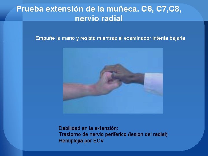 Prueba extensión de la muñeca. C 6, C 7, C 8, nervio radial Empuñe