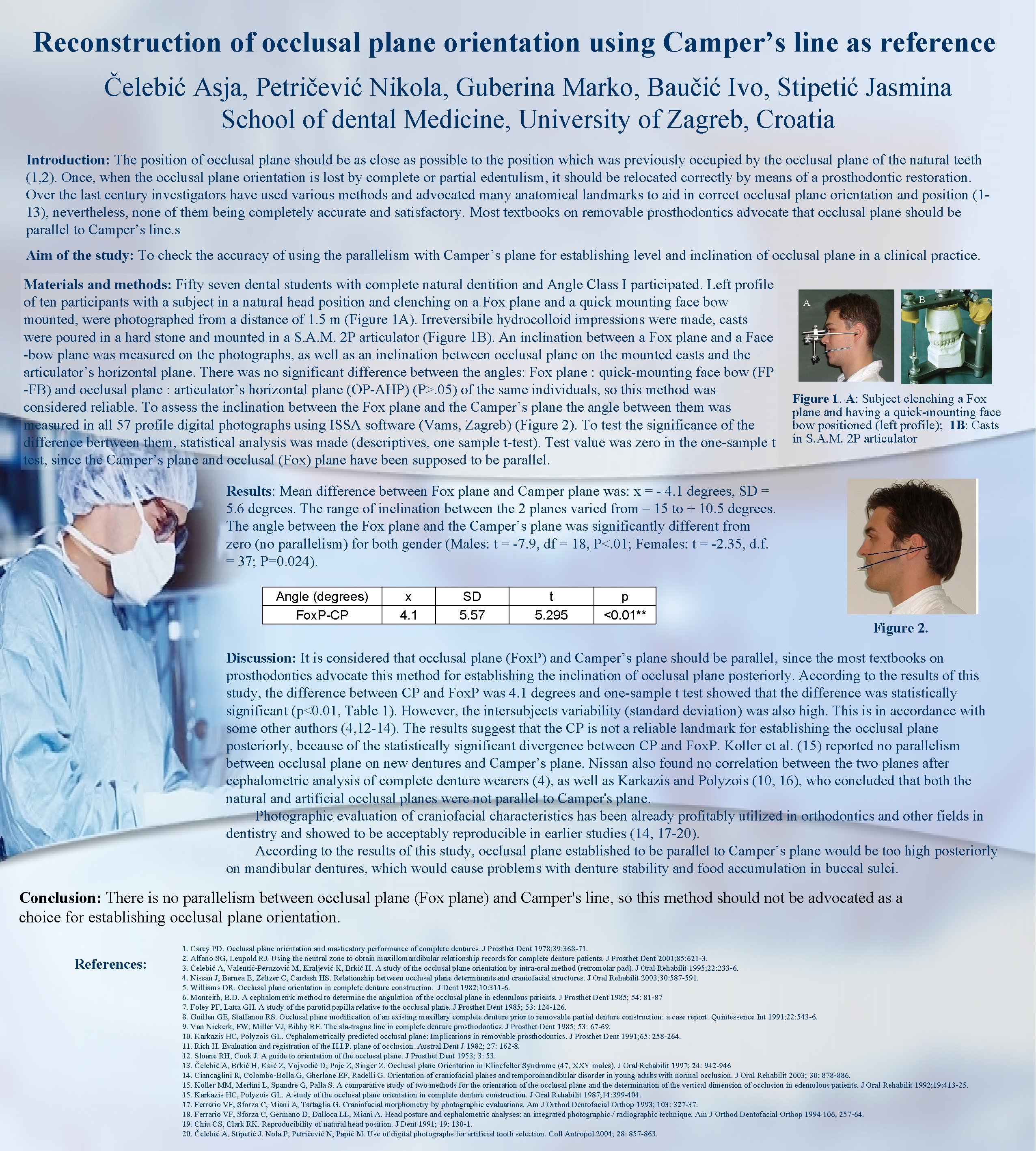 Reconstruction of occlusal plane orientation using Camper’s line as reference Čelebić Asja, Petričević Nikola,